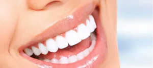 For a Natural and Radiant Smile: Zirconium Dental Crowns