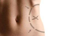 Abdominal, Arm, Leg Stretching