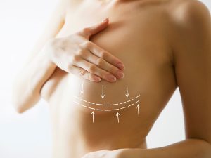 Breast Lift