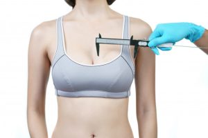 Breast Reduction
