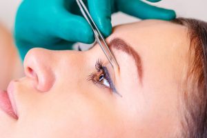 Eyelid Aesthetic (Blepharoplasty)