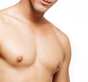 Gynecomastia